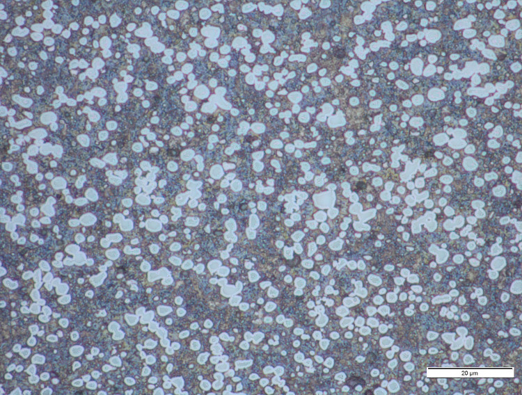 02 1000X-REX-121 32 % Carbide Volume.jpg