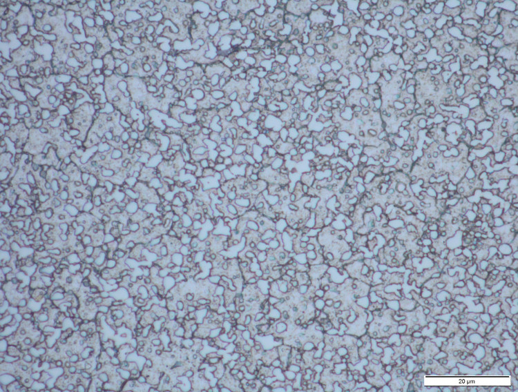 1000X-M390 22 % Carbide Volume.jpg