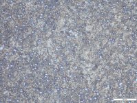 03 1000X-V4E 8 % Carbide Volume.jpg
