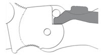 compresslock.jpg compresslock.jpg